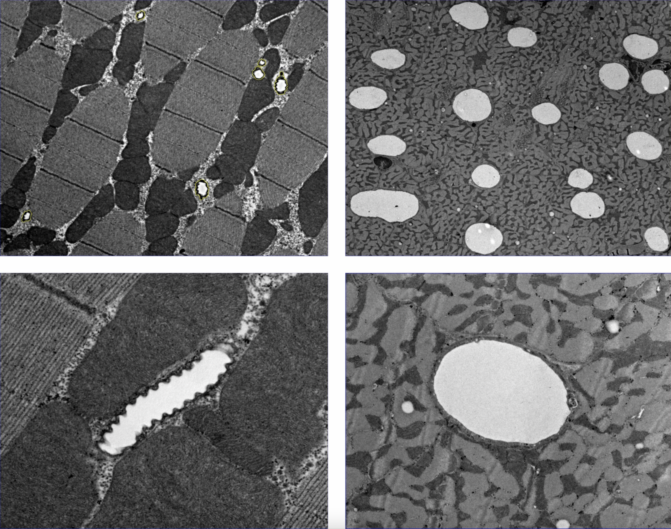 Insect flight muscle (left) compared against mammalian cardiac tissue (right), contrasting the different size and space needed to accommodate the oxygen-supply structures of insects (tracheoles) versus mammals (capillaries))
